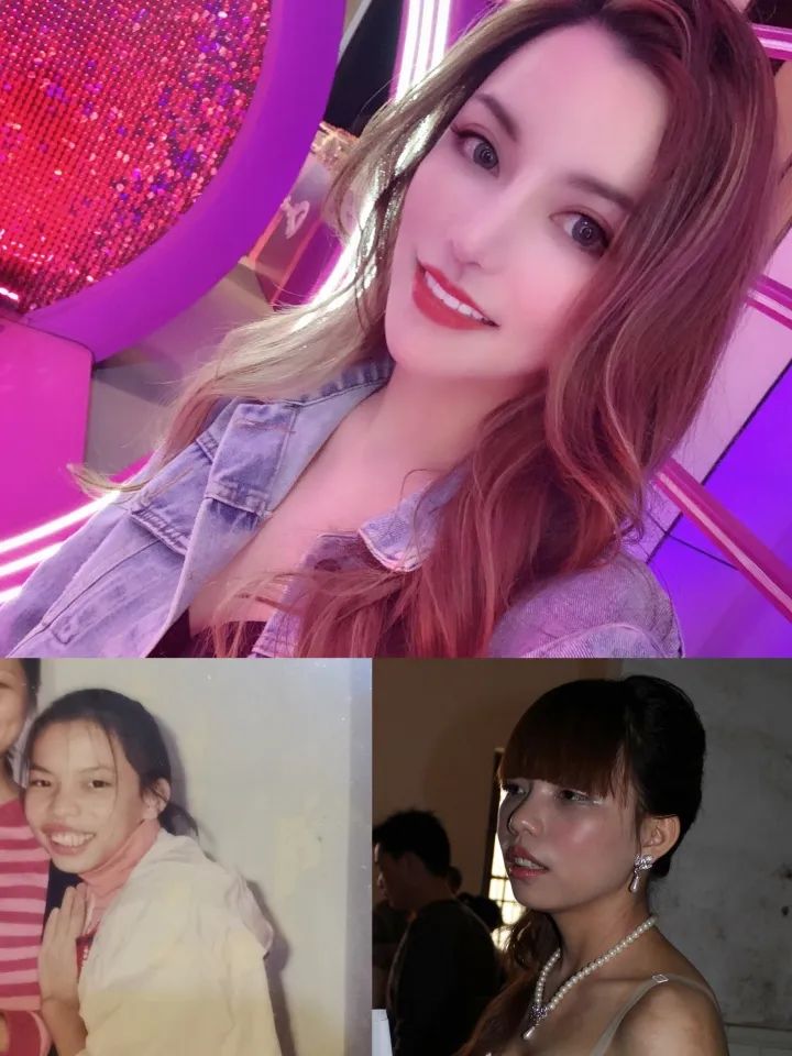 4436x12威尼斯官网想要一张和明星一样的脸35岁博主10年动刀132次！成果(图1)