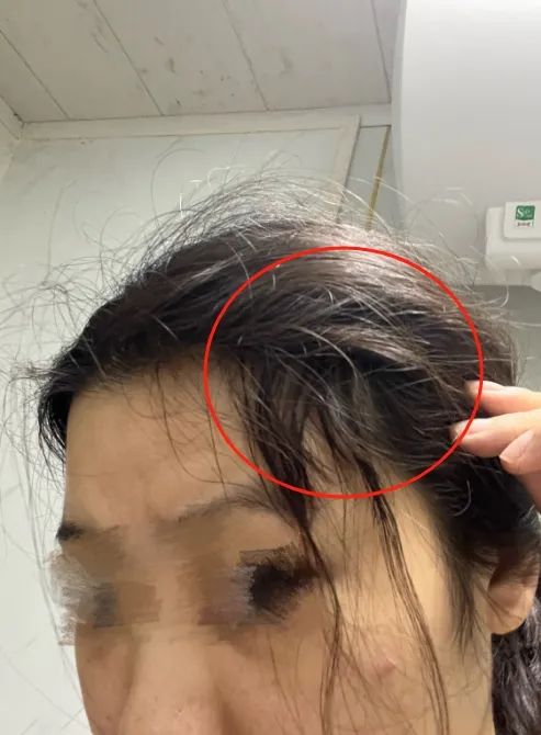 长沙女子头发被剪“秃”气得不愿出门！理发店：拿错剪刀了……(图2)