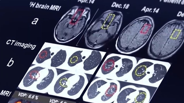 科学前沿极限突破计划启动实施