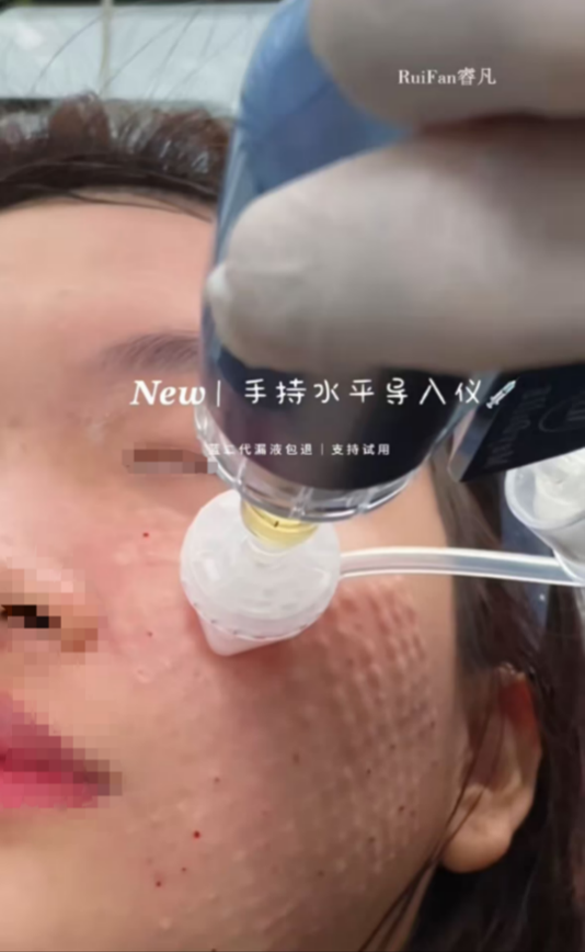 怎么推销医疗器械这种水光液单瓶成本不足1元，“居家水光”真是院线平替吗？_https://www.jmylbn.com_新闻资讯_第6张