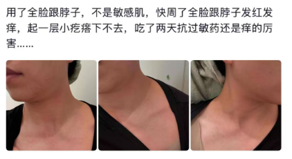 怎么推销医疗器械这种水光液单瓶成本不足1元，“居家水光”真是院线平替吗？_https://www.jmylbn.com_新闻资讯_第2张