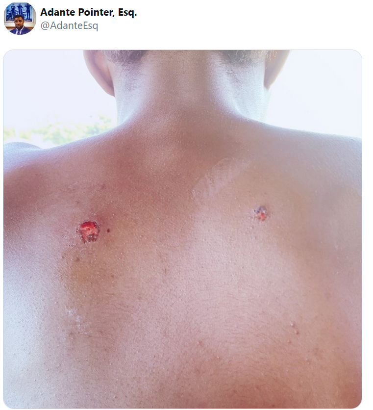 法庭文件爆料:美国加州两名警察朝黑人少年背上开枪,然后徒手取出子弹