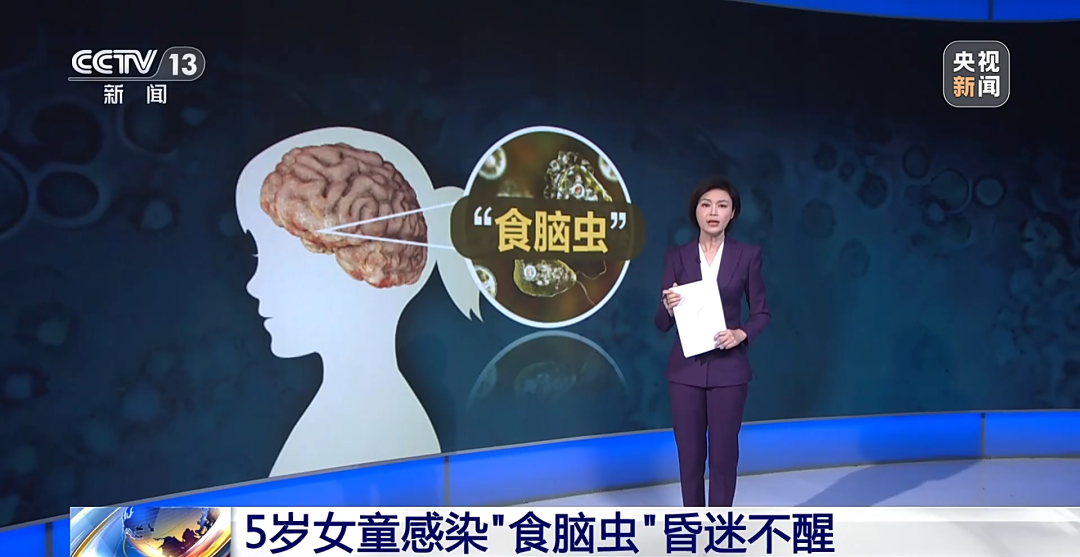 玩水会感染“食脑虫”？护鼻是关键插图