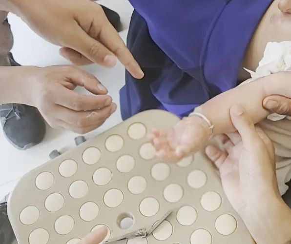 不到一岁的女宝遭烫伤，一对银手镯成了救治“拦路虎”插图