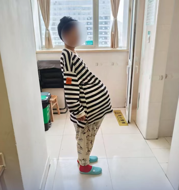 全国最大的肿瘤！湖南一女子盆腹腔长了38斤肿瘤，3个医生一起从其体内“抬出”，患者术后生命体征稳定插图