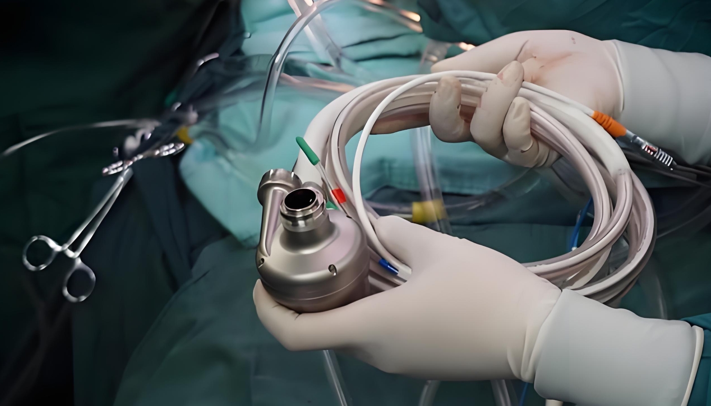 全球首例机器人操刀心脏移植手术成功