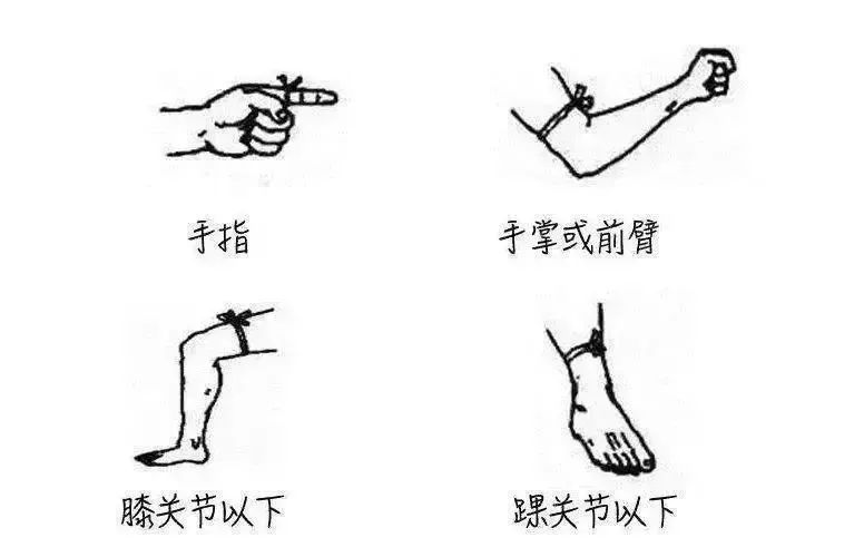 太惊险！广东一85岁老人被蛇追咬，用手杖将其击退！家属：疑似眼镜蛇插图6
