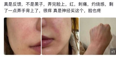 怎么推销医疗器械这种水光液单瓶成本不足1元，“居家水光”真是院线平替吗？_https://www.jmylbn.com_新闻资讯_第3张