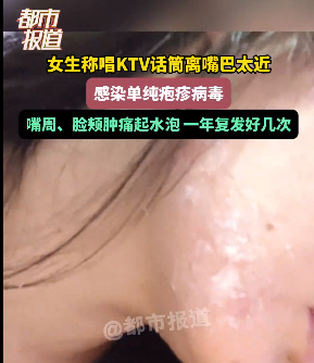 “终身携带，无药可治……” 浙江一女子唱K离话筒太近感染病毒插图