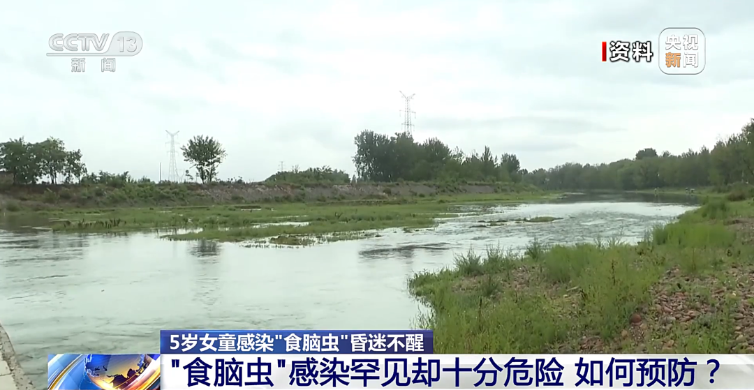 玩水会感染“食脑虫”？护鼻是关键插图3