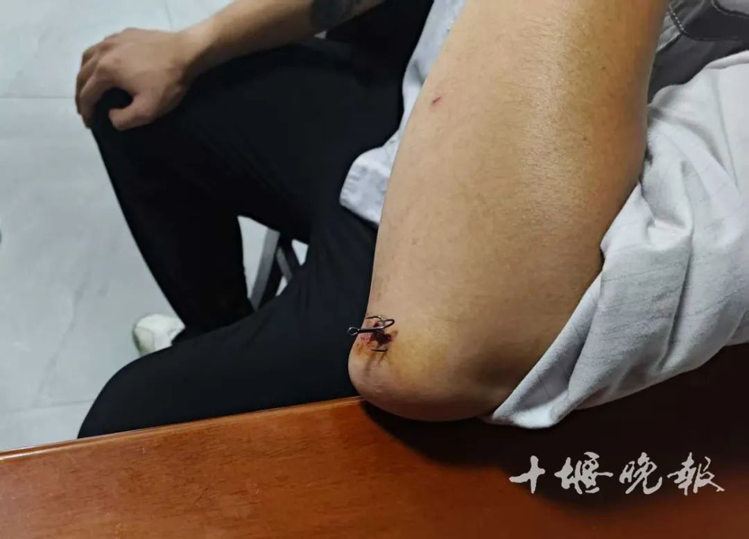 看着都疼！十堰男子胳膊被它钩住，消防提醒插图