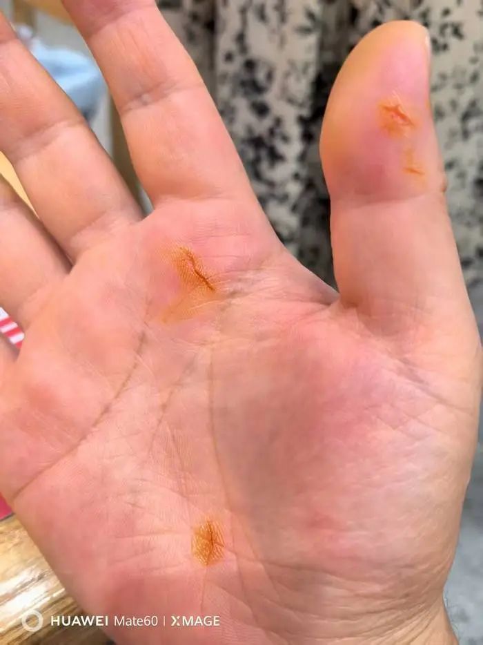 小伙不慎落水，“白衣大哥”飞奔入海施救，相关部门：落水者已获救，正为见义勇为者申请表彰插图3