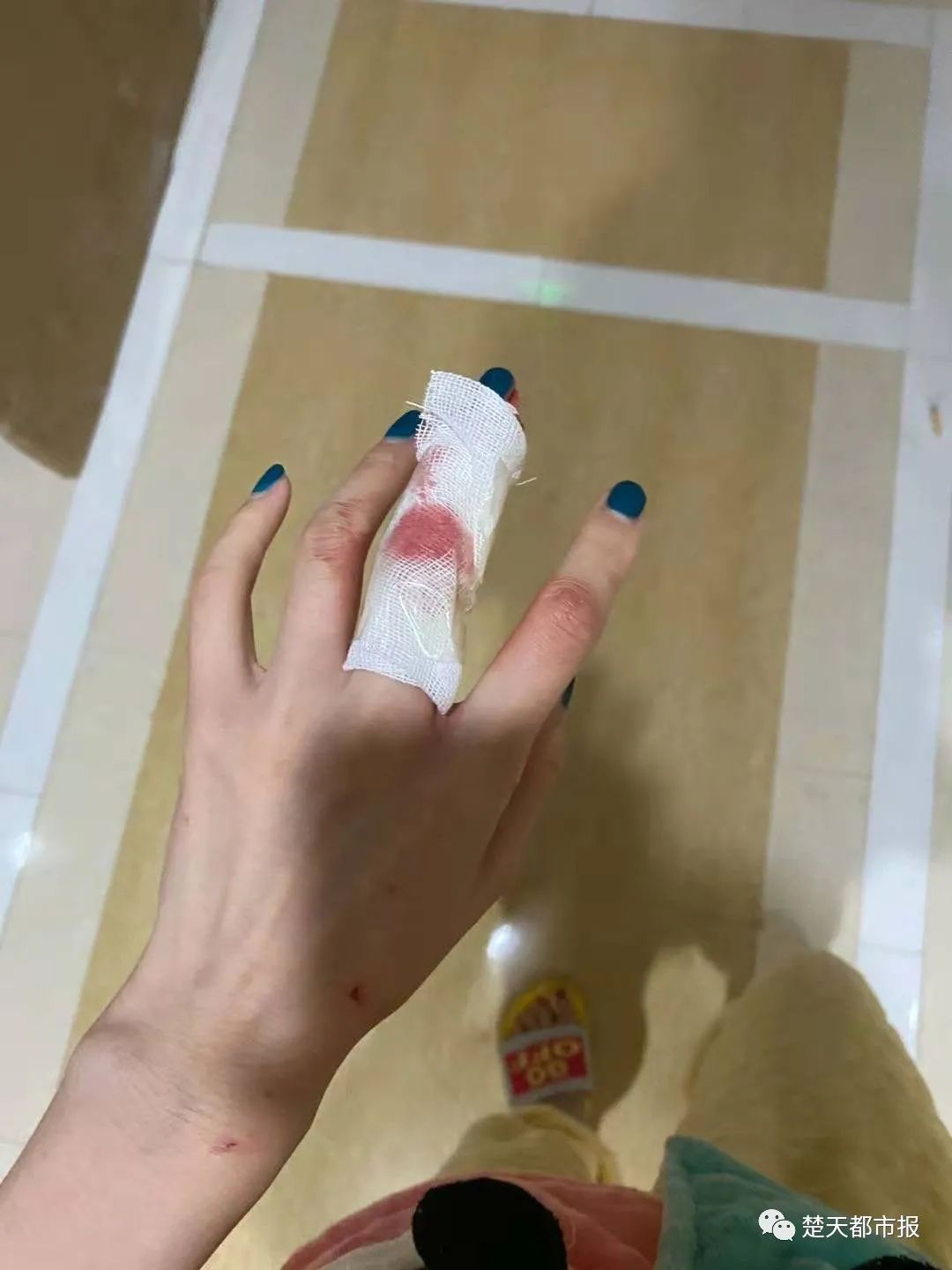 图片看着就好疼"女友受惊后退一步,脚被地上玻璃碎片扎伤血流不止